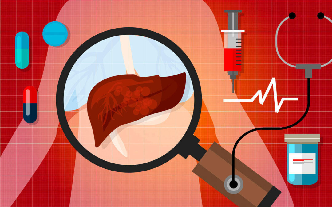 Dieta para tener una buena salud hepática