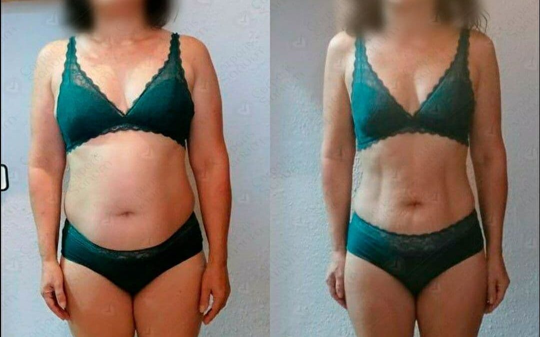 Caso de éxito de Ana