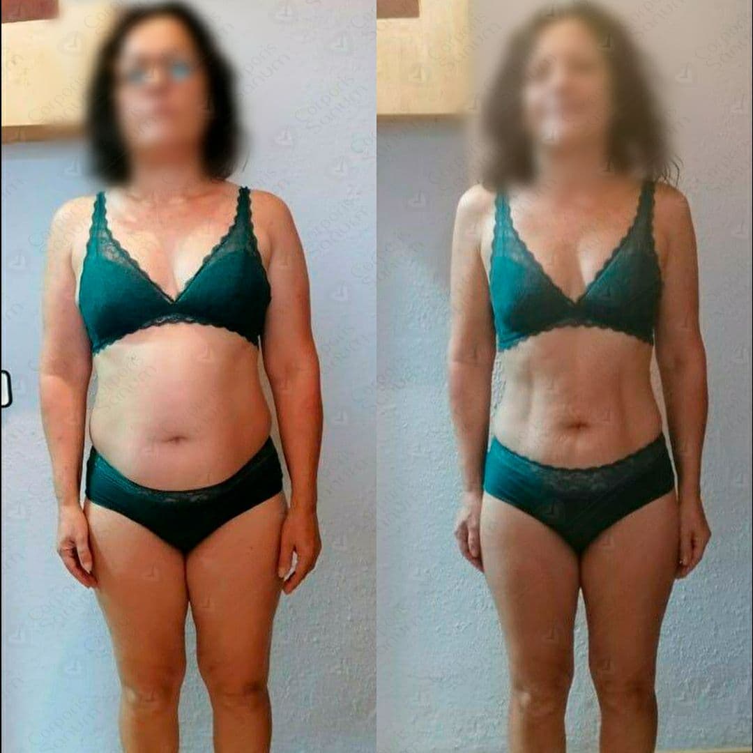Caso de éxito de Ana