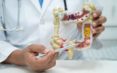 Alimentos para Desinflamar el Colón: Microbiota y Cerebro